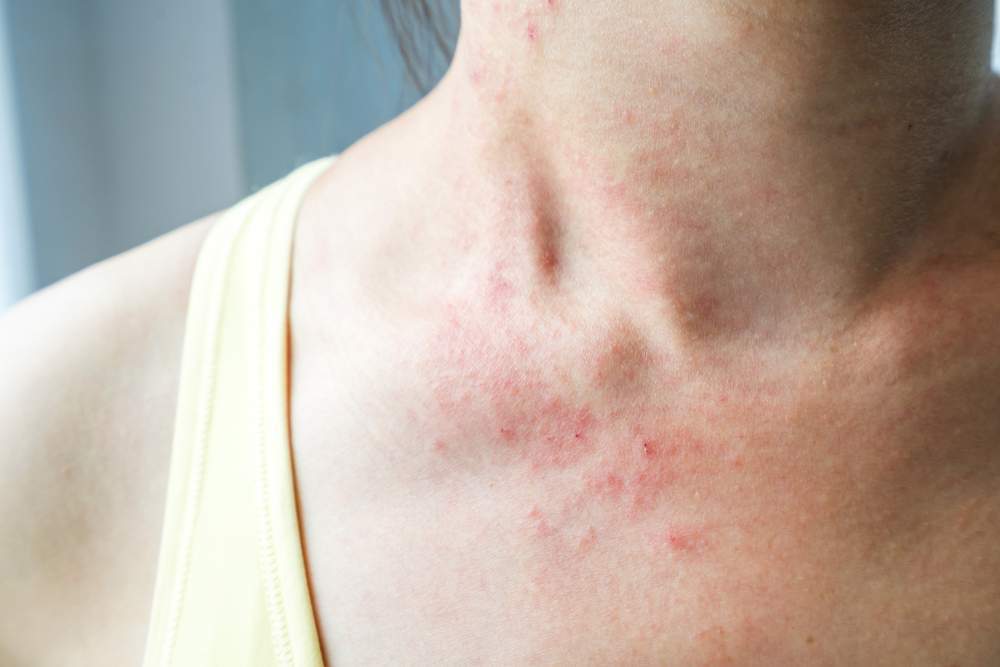 Nuovi esami: Faber Test, scopri la tua allergia con un solo test